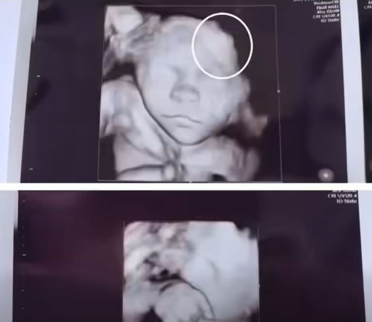 Mother is scared to see her daughter’s ultrasound; image showed the…